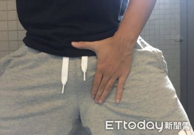 男性的GG為何會「突變90度上翹」？醫師揭示驚人原因與矯正方法