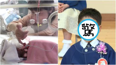 出生僅258克!世界最輕「巴掌寶寶」6歲了 長大模樣曝:想當警察