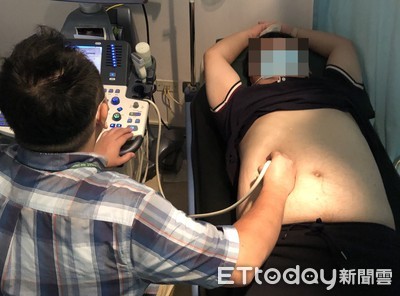 脂肪肝危機：醫師揭示5大元凶與4大防癌策略