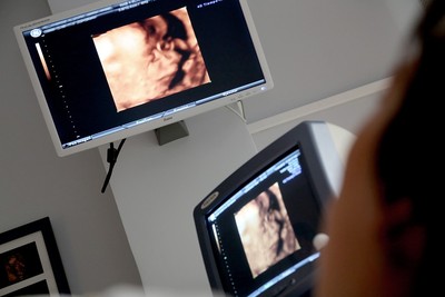 2次人工受孕才成功!尪「感動變想吐」喊壓力大 她聽4理由心碎